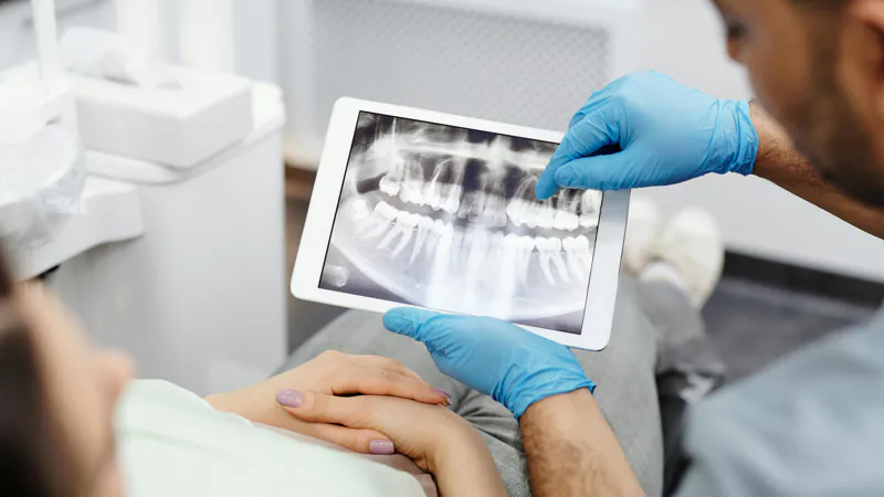 unique-smile-endodontia-02 dentista com raio-x