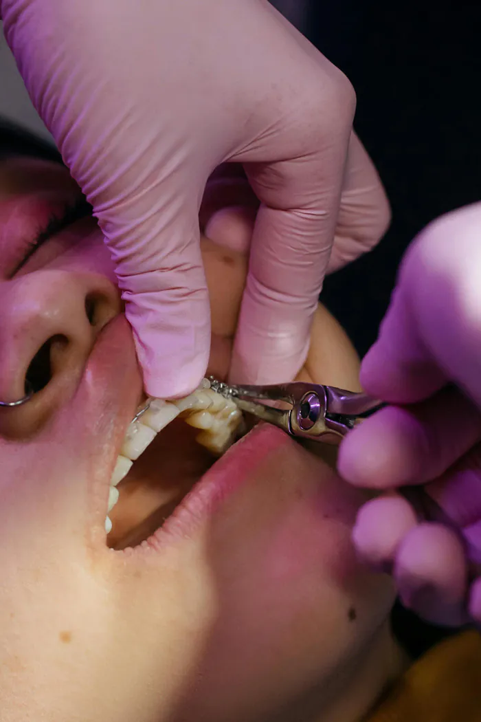 unique-smile-implantes-dentários-03
